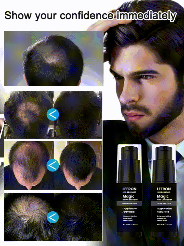 HOEGOA Hair Concealer