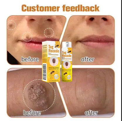 Tagrecede Bees Treatment Spray