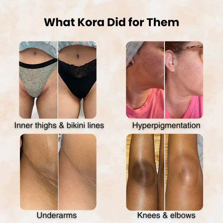 Turmeric & Kojic Acid - Skin Brightening Soap