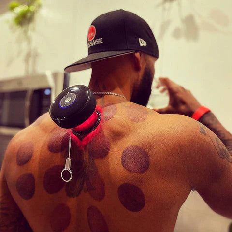 Cupping Master - Hijama 💪