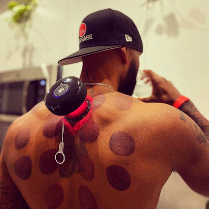 Cupping Master - Hijama 💪
