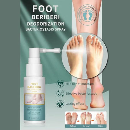 Ansiyi - Foot Bacteria Bacteriostasis Spray (Original)