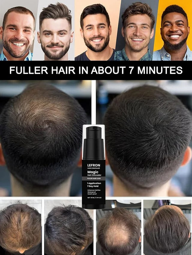 HOEGOA Hair Concealer