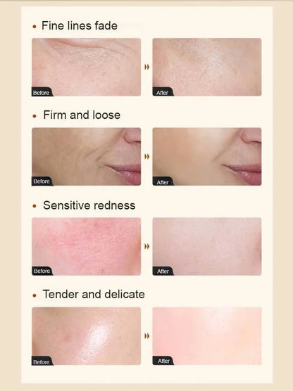 [Skin counter growth] Collagen anti wrinkle essence